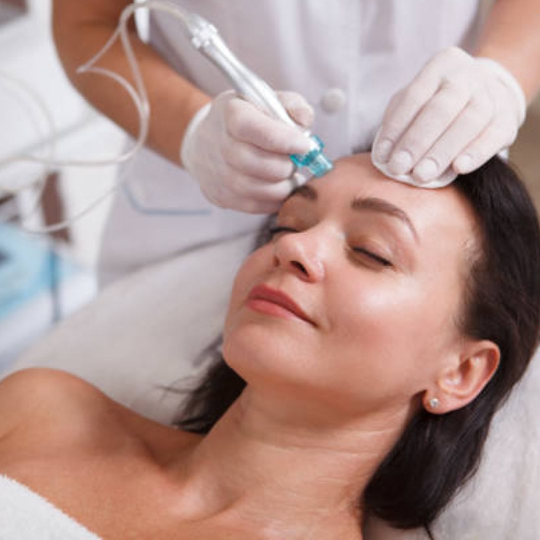 Achieving Youthful Skin with HydraFacial: Targeting Fine Lines and Wrinkles