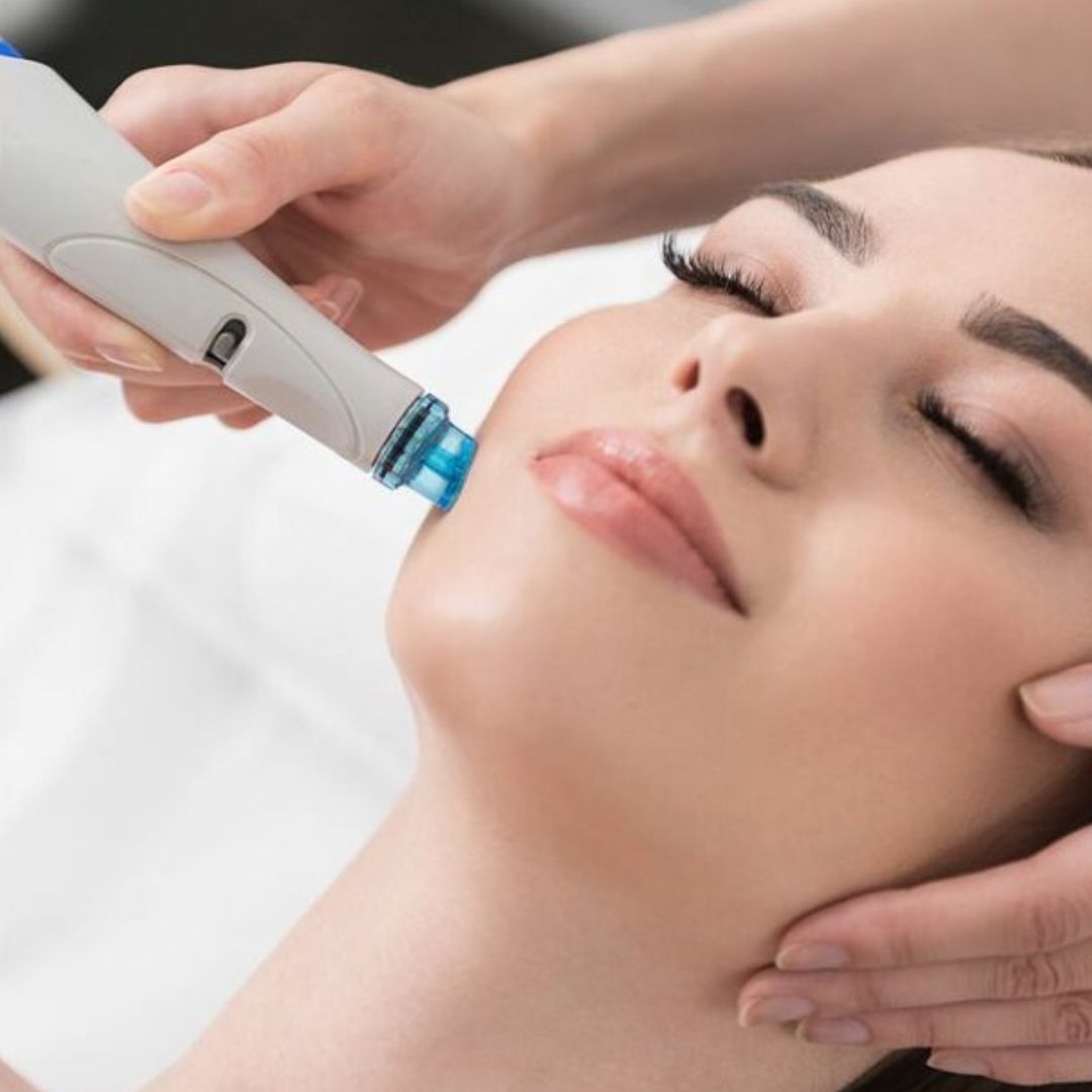 HydraFacial for Sensitive Skin: A Gentle Approach