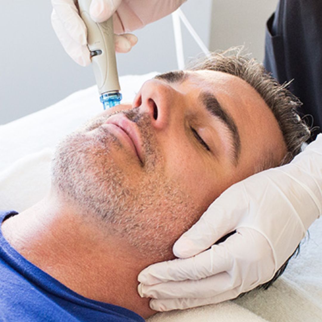 HydraFacial for Men: Why Skincare Isn’t Just for Women