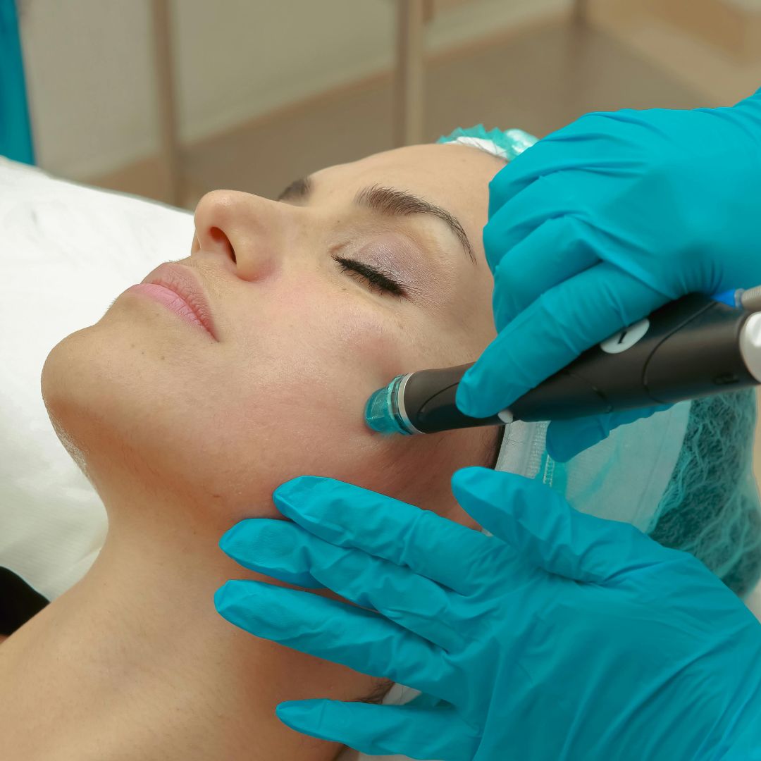 HydraFacial vs. Traditional Facials: Which One is Better for Your Skin?