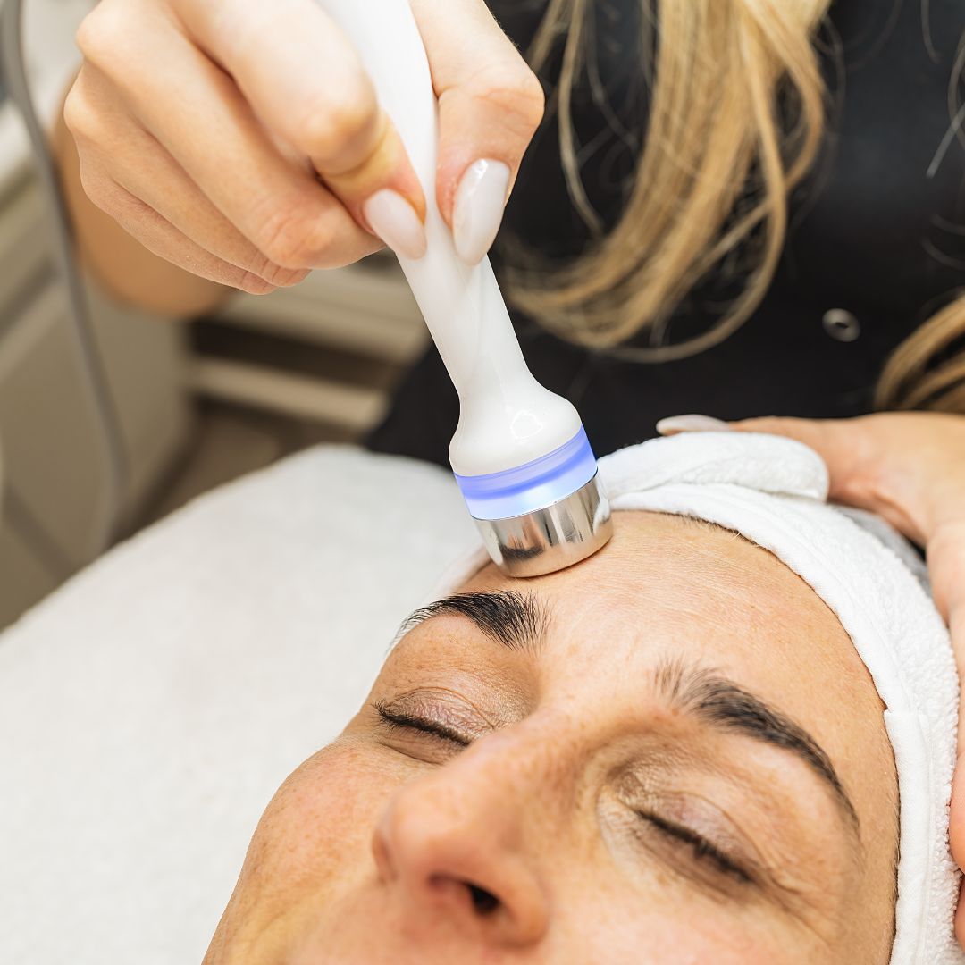 The Role of HydraFacial in Managing Acne and Blackheads